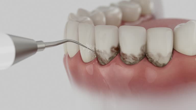 Reliable Emergency Dentist contractor in Desloge, MO by Smile Center Dentistry